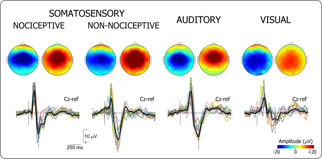 EEG responses at the scalp vertex, evoked by sudden transient stimuli of several sensory modalities